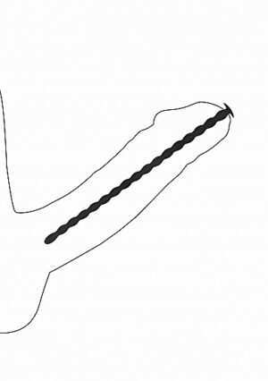 Silicone Spiral Screw Plug Set - Advanced Urethral Sounding - Bl - Afbeelding 7